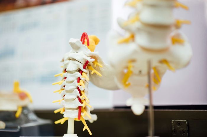 Lumbar Tumor Misdiagnosis Lawyer